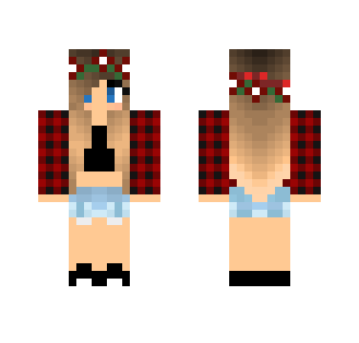 My skin