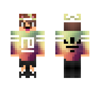 My skin