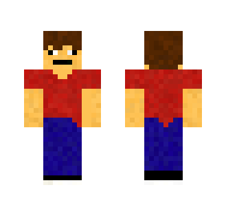 My Skin (UPDATED)