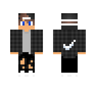 My skin!