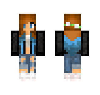 My Skin q-q