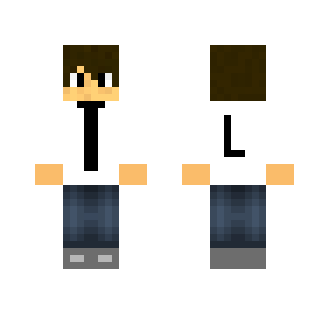 My skin