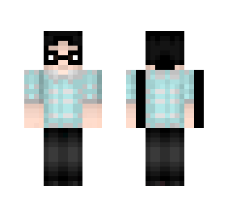 James Lorenzo skin revamp