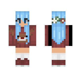 My sisters skin Saule_