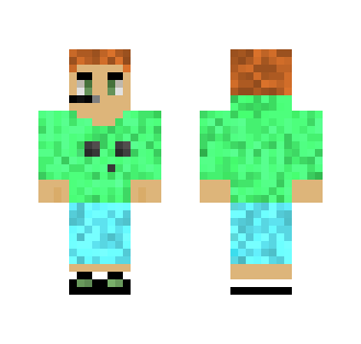 My Skin