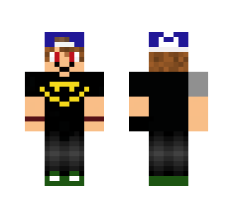 tylers skin