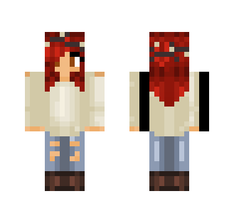 My skin