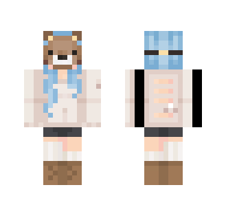 My skin