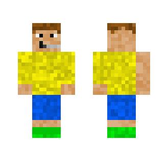Alex's Skin