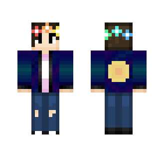 Skin request.