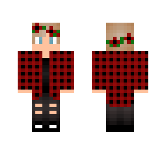 Micah's skin