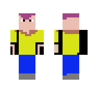 my skin
