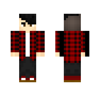 My skin