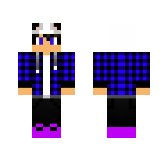 My Skin/Minha Skin