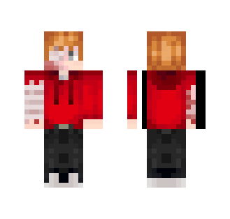 Injured Tord - Eddsworld