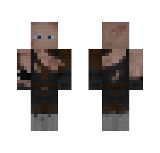 Battle Damaged Anakin Skywalker