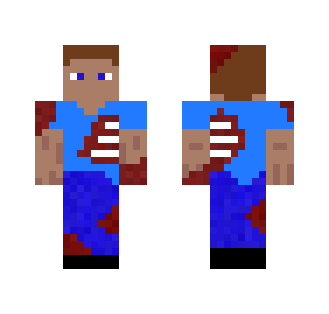 Bloody Steve