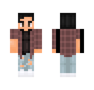 alec's skin