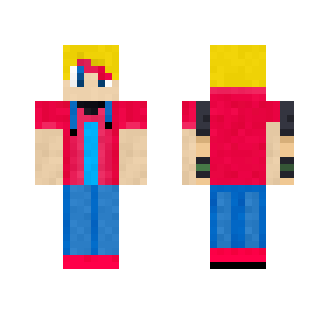 My skin