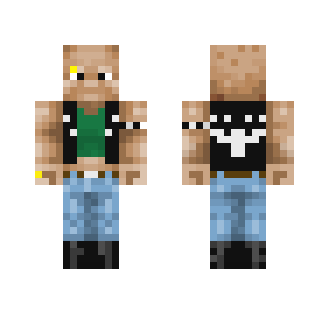 Skinhead