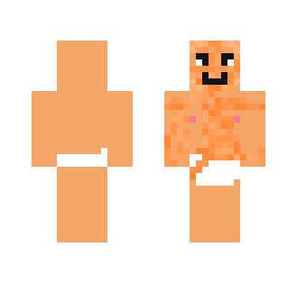 Horrible skin: Sunburn