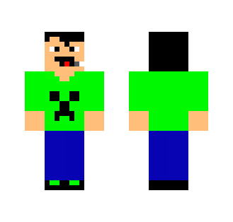 Normal Skin