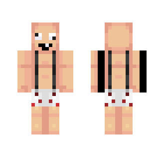 (Derp/Noob)