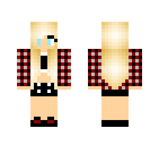 My skin