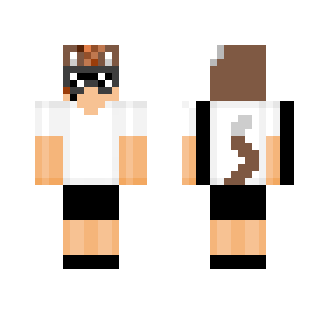 My skin NORMAL (update)