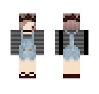 My skin