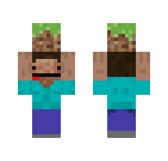 I missed yesterday skin post srry