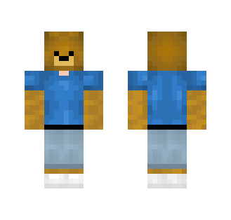 My skin