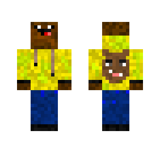 My normal skin, pretty beartastic